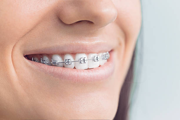 Best Full Mouth Reconstruction  in St Joseph, IL